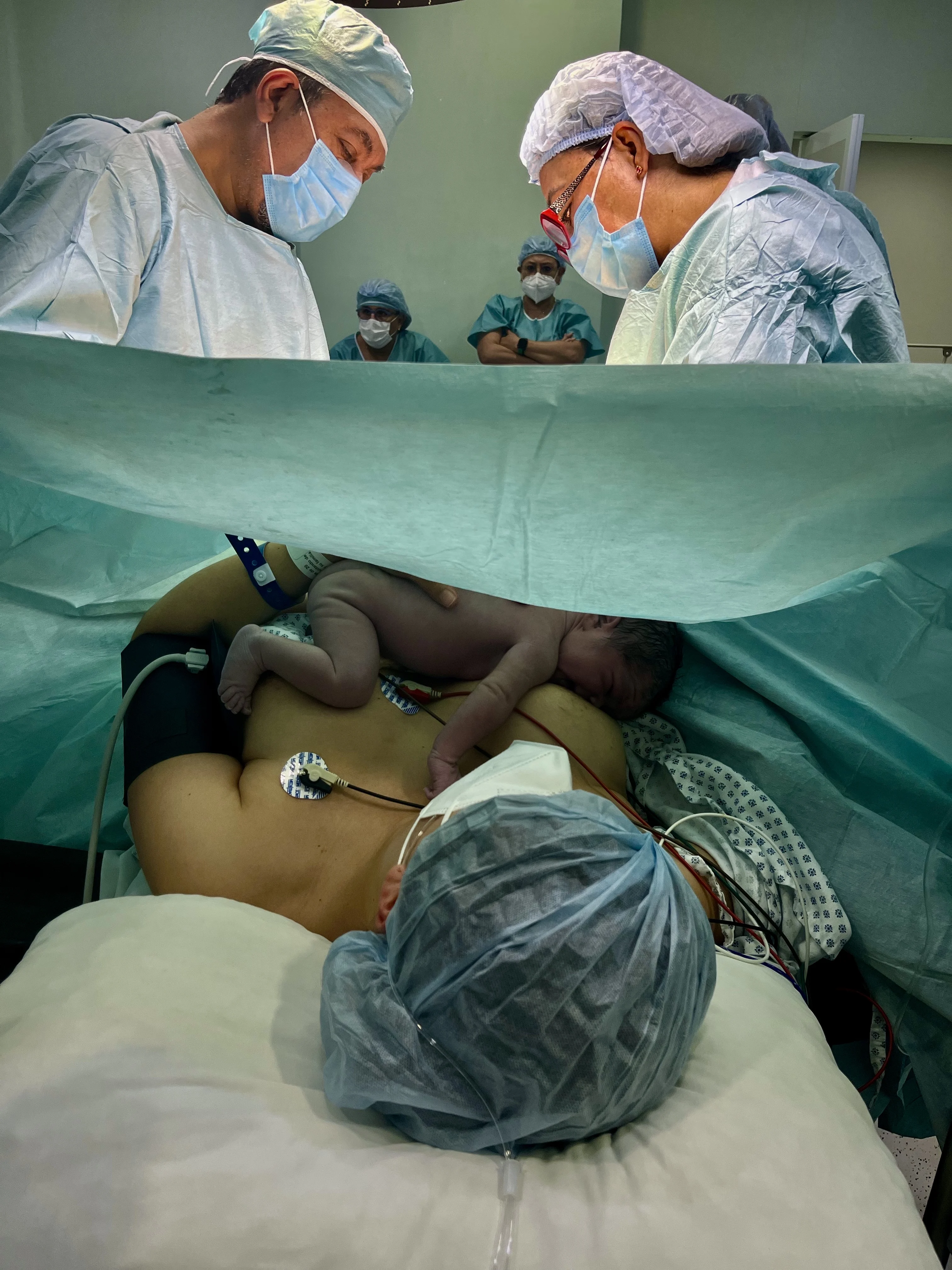 Cesárea con enfoque humanizado