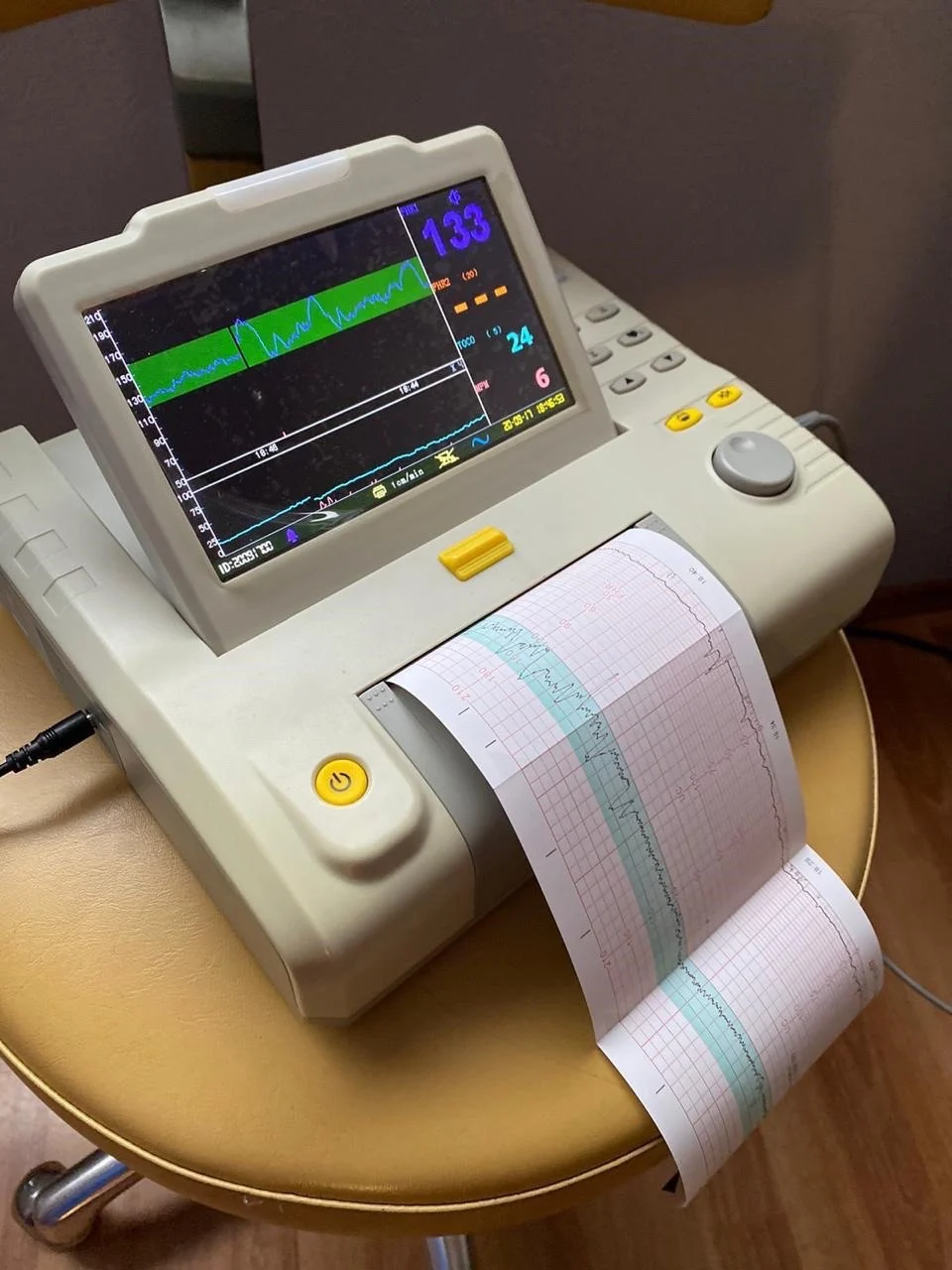 Registro cardiotocográfico